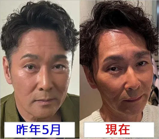 元木大介　激痩せ理由